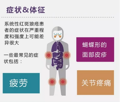 请问:红斑狼疮是什么症状图片一览表 请问:红斑狼疮是什么症状图片一览表