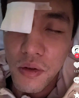 郭艾伦结膜破碎,眼睛里缝了40多针!运动损伤不容小觑_现代网新闻频道