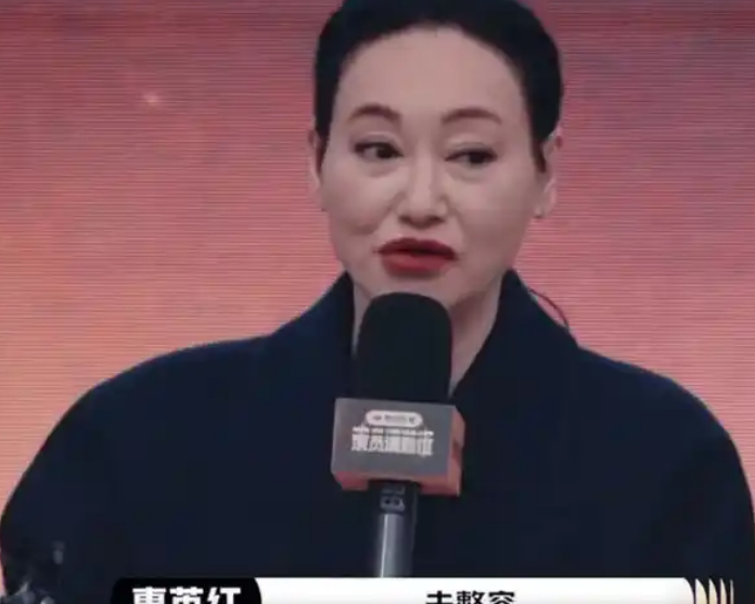 惠英红拍戏受伤脸部缝89针 敬业精神获网友点赞_现代网新闻频道