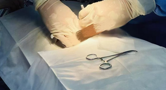 西南首例戒酒芯片植入术成功实施,科技助力健康生活_现代网新闻频道